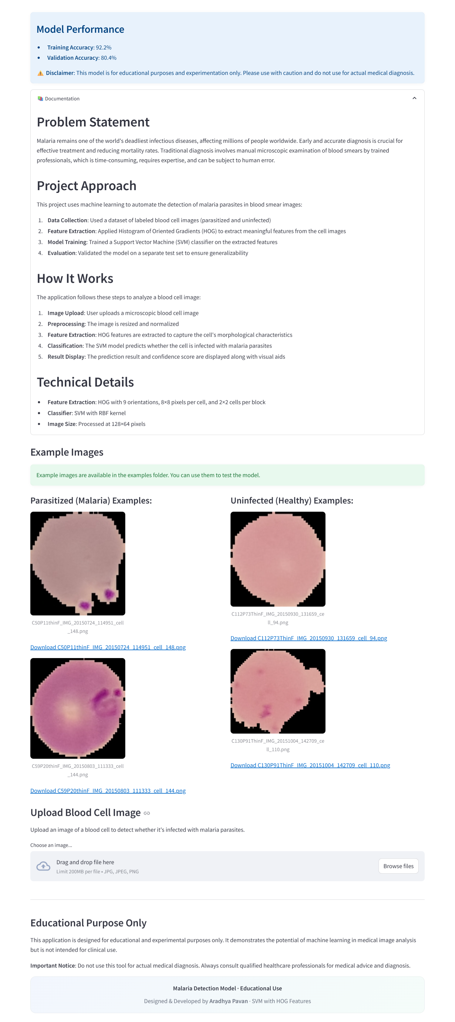 Malaria Cell Detection - App
